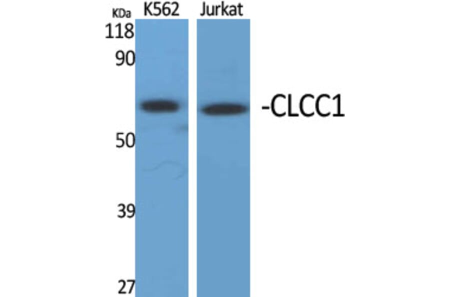 Western blot - CLCC1 Polyclonal Antibody from Signalway Antibody (40757) - Antibodies.com
