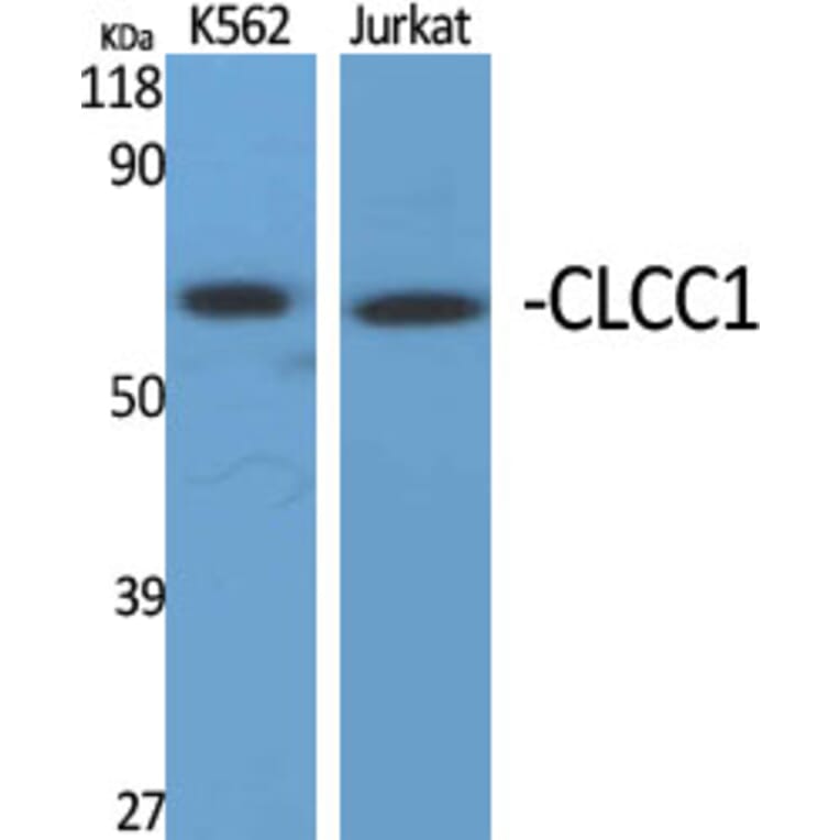 Western blot - CLCC1 Polyclonal Antibody from Signalway Antibody (40757) - Antibodies.com