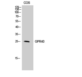 Western blot - GPR40 Polyclonal Antibody from Signalway Antibody (40981) - Antibodies.com