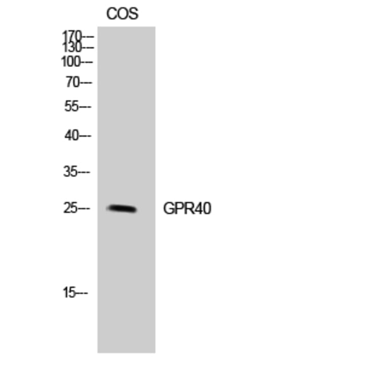 Western blot - GPR40 Polyclonal Antibody from Signalway Antibody (40981) - Antibodies.com