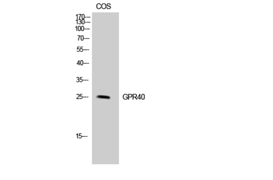 Western blot - GPR40 Polyclonal Antibody from Signalway Antibody (40981) - Antibodies.com