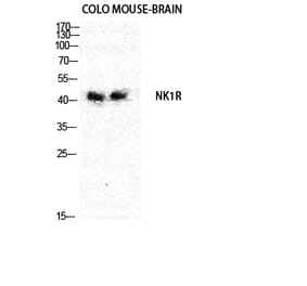 Western blot - NK-1R Polyclonal Antibody from Signalway Antibody (41243) - Antibodies.com