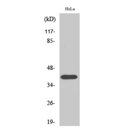 Western blot - P2RY8 Polyclonal Antibody from Signalway Antibody (41301) - Antibodies.com