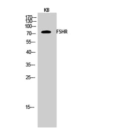 Western blot - FSHR Polyclonal Antibody from Signalway Antibody (40941) - Antibodies.com