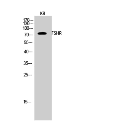 Western blot - FSHR Polyclonal Antibody from Signalway Antibody (40941) - Antibodies.com