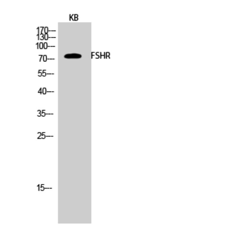 Western blot - FSHR Polyclonal Antibody from Signalway Antibody (40941) - Antibodies.com