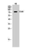 Western blot - FSHR Polyclonal Antibody from Signalway Antibody (40941) - Antibodies.com