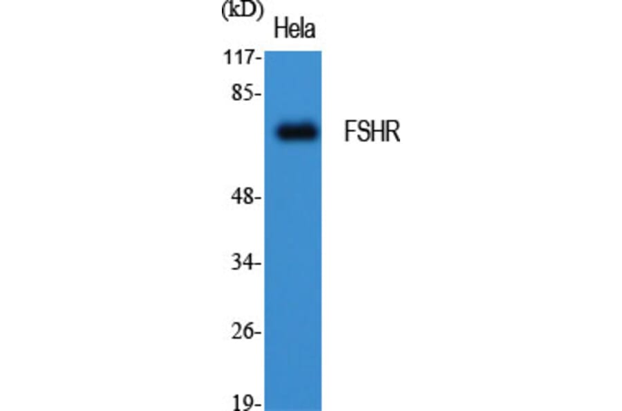 Western blot - FSHR Polyclonal Antibody from Signalway Antibody (40941) - Antibodies.com