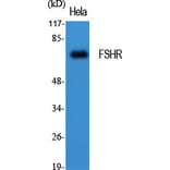 Western blot - FSHR Polyclonal Antibody from Signalway Antibody (40941) - Antibodies.com