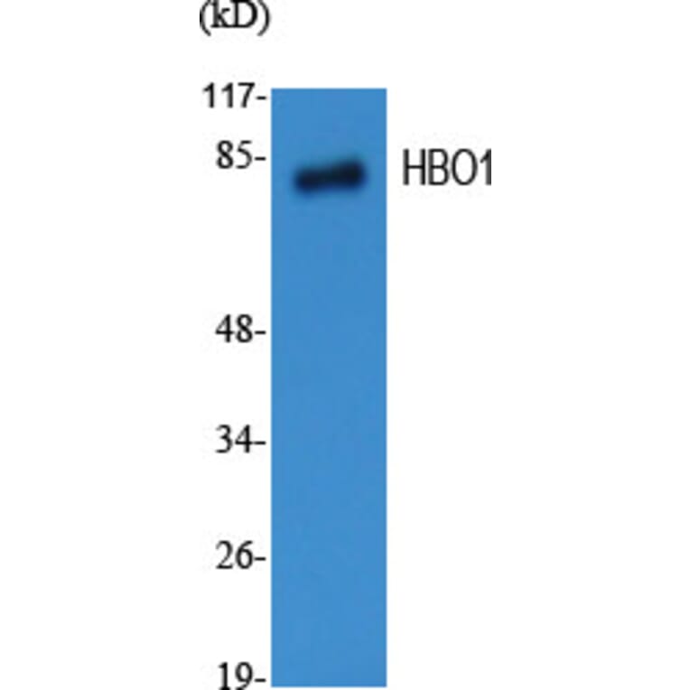 Western blot - HBO1 Polyclonal Antibody from Signalway Antibody (40993) - Antibodies.com