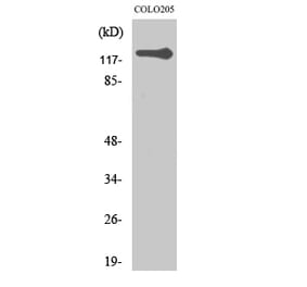 Western blot - TERT Polyclonal Antibody from Signalway Antibody (41486) - Antibodies.com