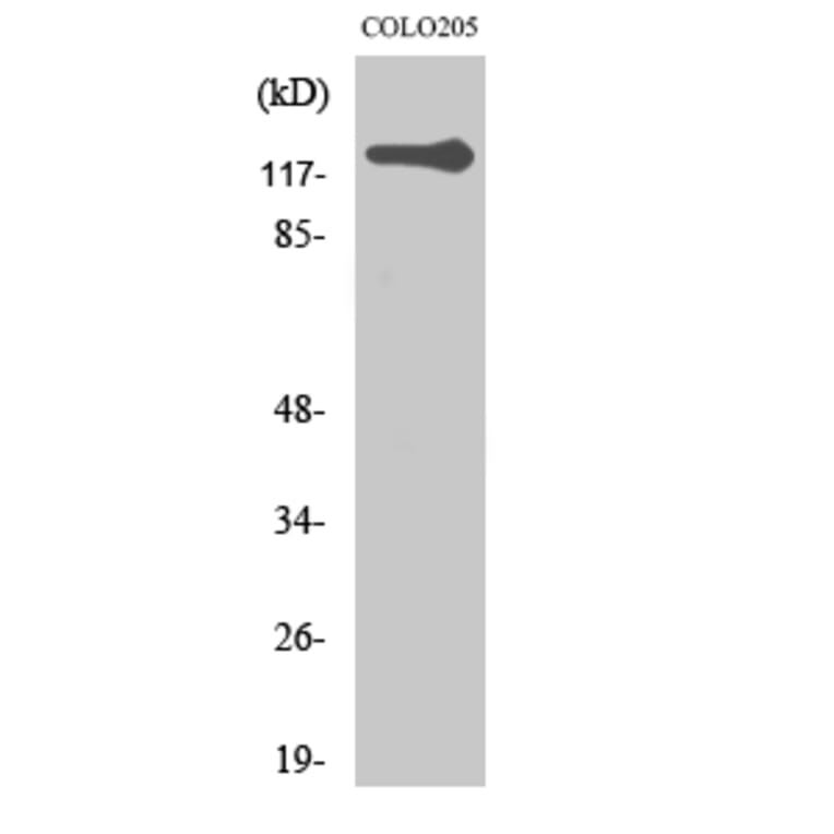 Western blot - TERT Polyclonal Antibody from Signalway Antibody (41486) - Antibodies.com