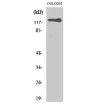Western blot - TERT Polyclonal Antibody from Signalway Antibody (41486) - Antibodies.com