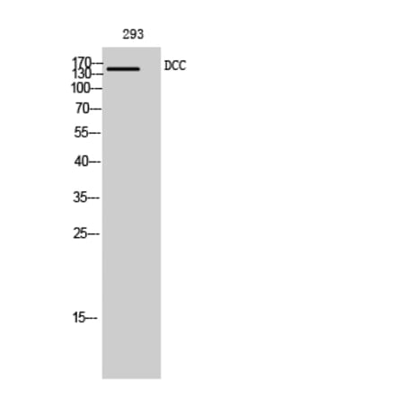 Western blot - DCC Polyclonal Antibody from Signalway Antibody (40835) - Antibodies.com