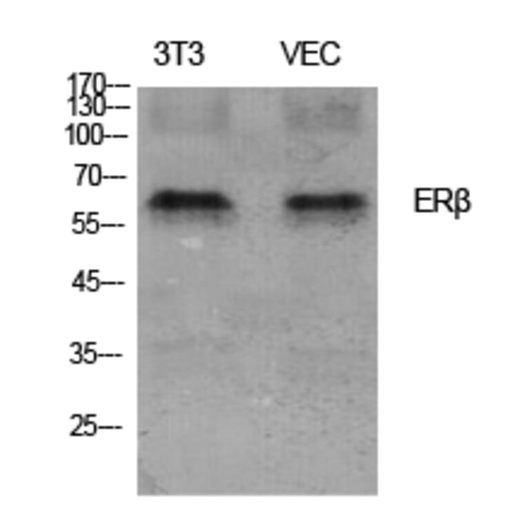 Western blot - ERβ Polyclonal Antibody from Signalway Antibody (40908) - Antibodies.com