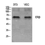 Western blot - ERβ Polyclonal Antibody from Signalway Antibody (40908) - Antibodies.com