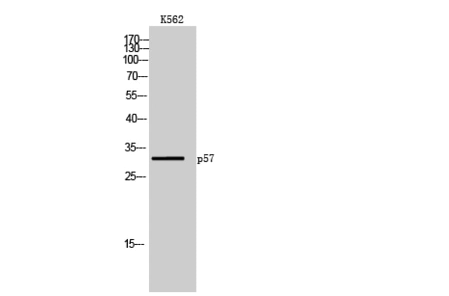 Western blot - p57 Polyclonal Antibody from Signalway Antibody (41315) - Antibodies.com
