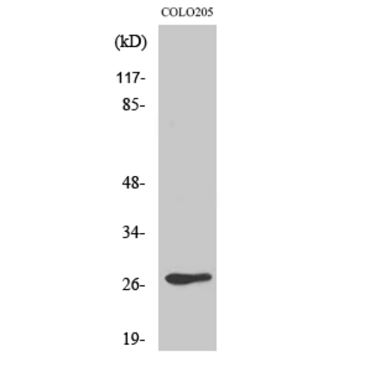 Western blot - Olfactory receptor 5D3 Polyclonal Antibody from Signalway Antibody (41280) - Antibodies.com