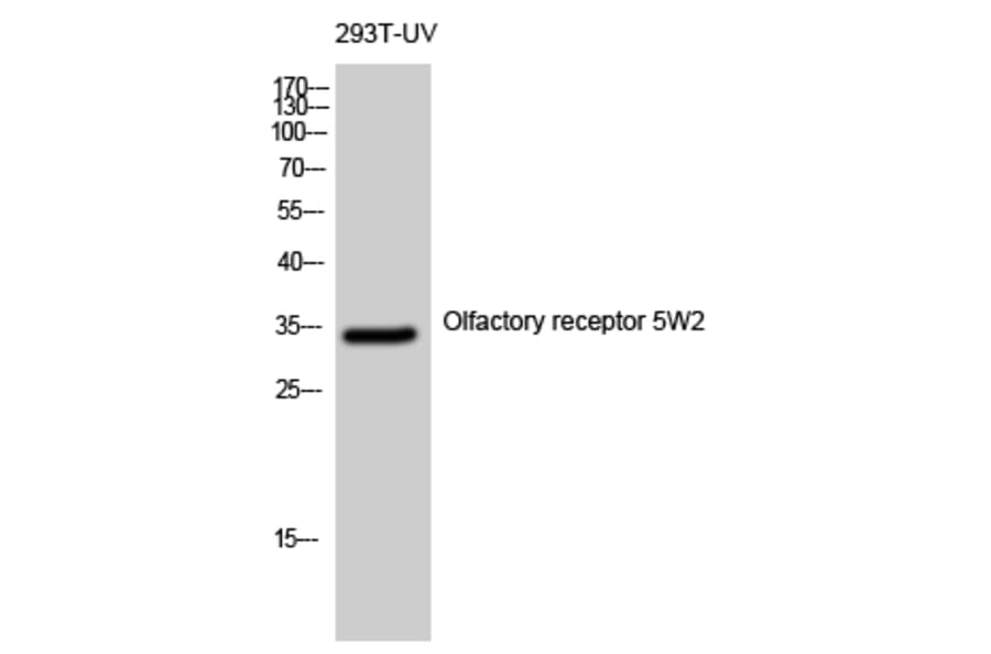 Western blot - Olfactory receptor 5W2 Polyclonal Antibody from Signalway Antibody (41283) - Antibodies.com