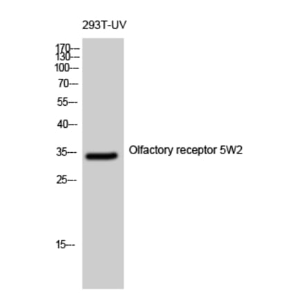 Western blot - Olfactory receptor 5W2 Polyclonal Antibody from Signalway Antibody (41283) - Antibodies.com