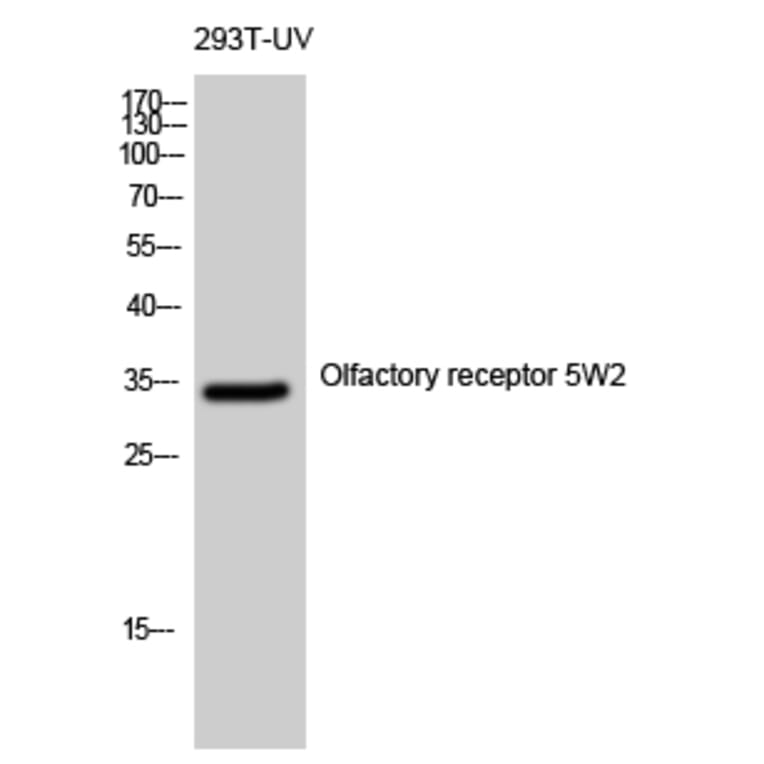 Western blot - Olfactory receptor 5W2 Polyclonal Antibody from Signalway Antibody (41283) - Antibodies.com
