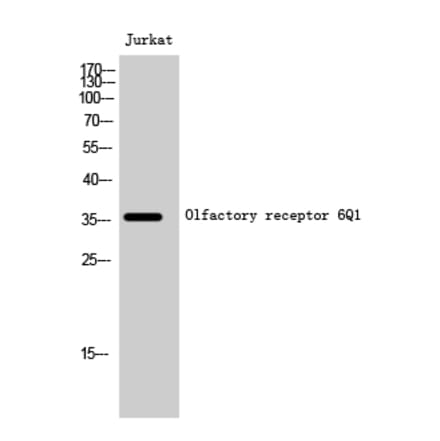 Western blot - Olfactory receptor 6Q1 Polyclonal Antibody from Signalway Antibody (41284) - Antibodies.com