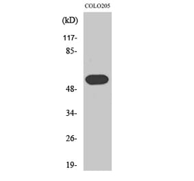 Western blot - Histamine H1 Receptor Polyclonal Antibody from Signalway Antibody (41007) - Antibodies.com