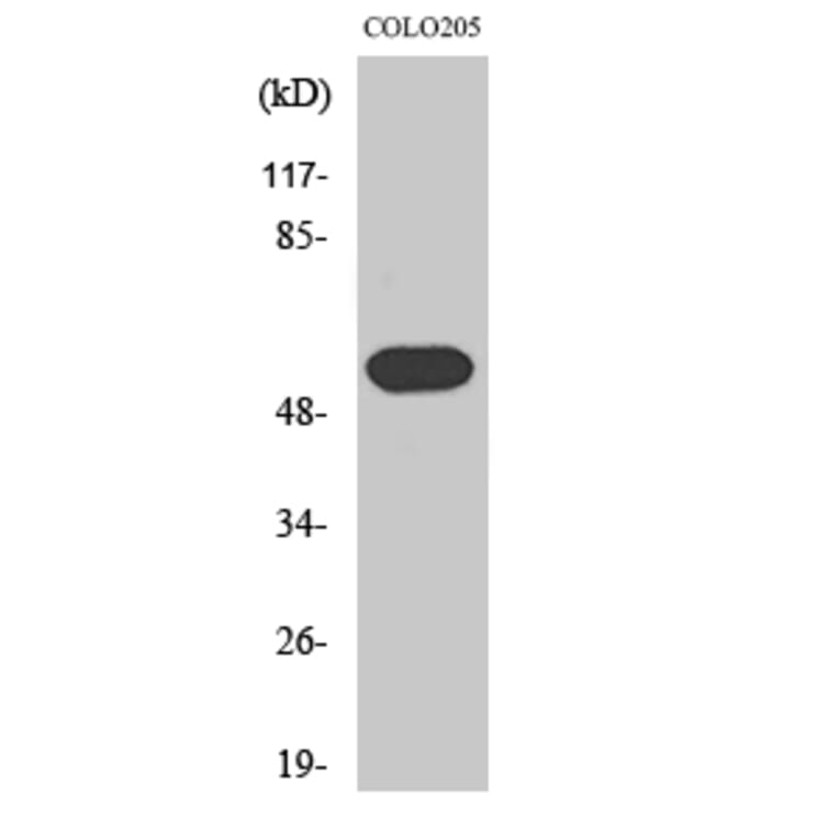 Western blot - Histamine H1 Receptor Polyclonal Antibody from Signalway Antibody (41007) - Antibodies.com