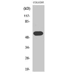 Western blot - Histamine H1 Receptor Polyclonal Antibody from Signalway Antibody (41007) - Antibodies.com