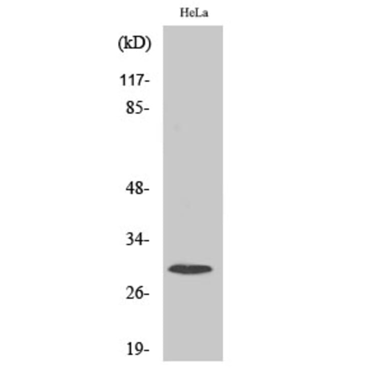 Western blot - Ribosomal Protein S4X Polyclonal Antibody from Signalway Antibody (41409) - Antibodies.com