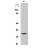 Western blot - Ribosomal Protein S4X Polyclonal Antibody from Signalway Antibody (41409) - Antibodies.com