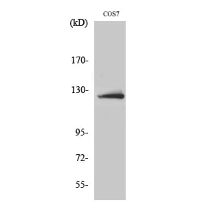 Western blot - ATP-citrate synthase Polyclonal Antibody from Signalway Antibody (40630) - Antibodies.com