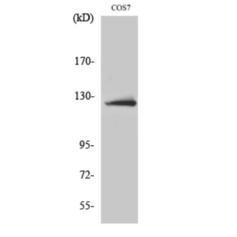 Western blot - ATP-citrate synthase Polyclonal Antibody from Signalway Antibody (40630) - Antibodies.com
