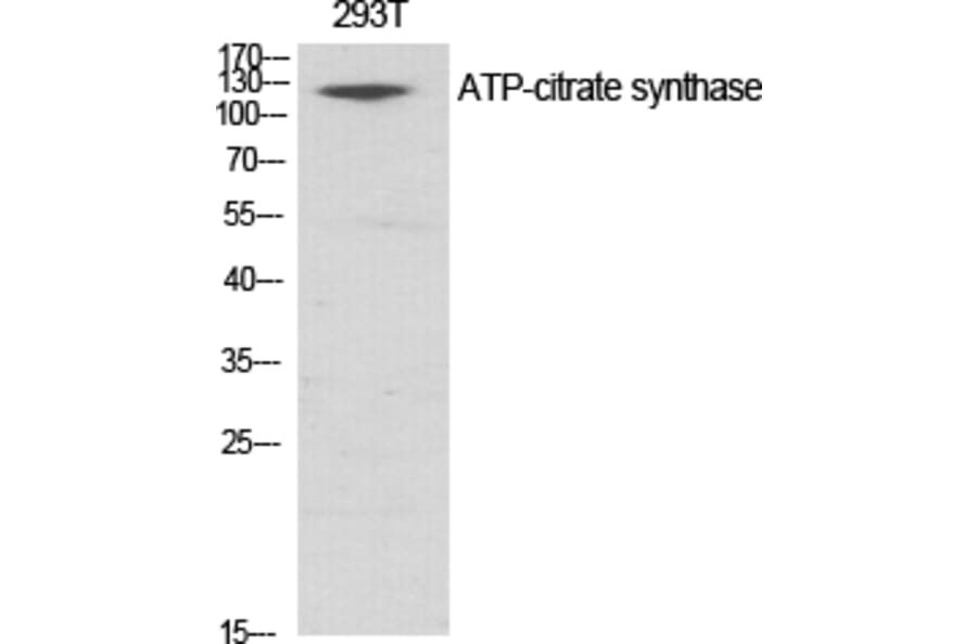 Western blot - ATP-citrate synthase Polyclonal Antibody from Signalway Antibody (40630) - Antibodies.com