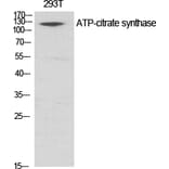 Western blot - ATP-citrate synthase Polyclonal Antibody from Signalway Antibody (40630) - Antibodies.com