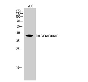 Western blot - EKLF/CKLF/UKLF Polyclonal Antibody from Signalway Antibody (40873) - Antibodies.com