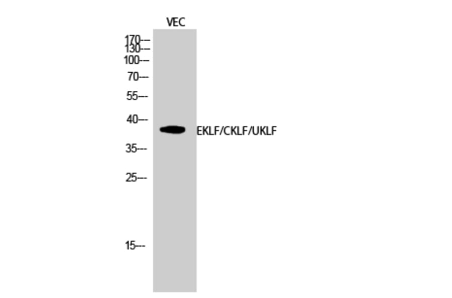 Western blot - EKLF/CKLF/UKLF Polyclonal Antibody from Signalway Antibody (40873) - Antibodies.com