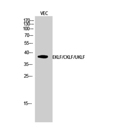 Western blot - EKLF/CKLF/UKLF Polyclonal Antibody from Signalway Antibody (40873) - Antibodies.com