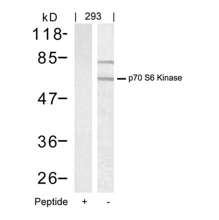 Western blot - p70 S6 Kinase (Ab-389) Antibody from Signalway Antibody (21182) - Antibodies.com