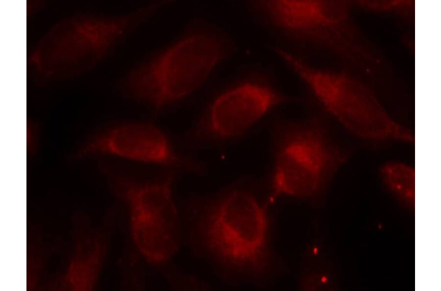 Immunofluorescence - p70 S6 Kinase (Ab-389) Antibody from Signalway Antibody (21182) - Antibodies.com