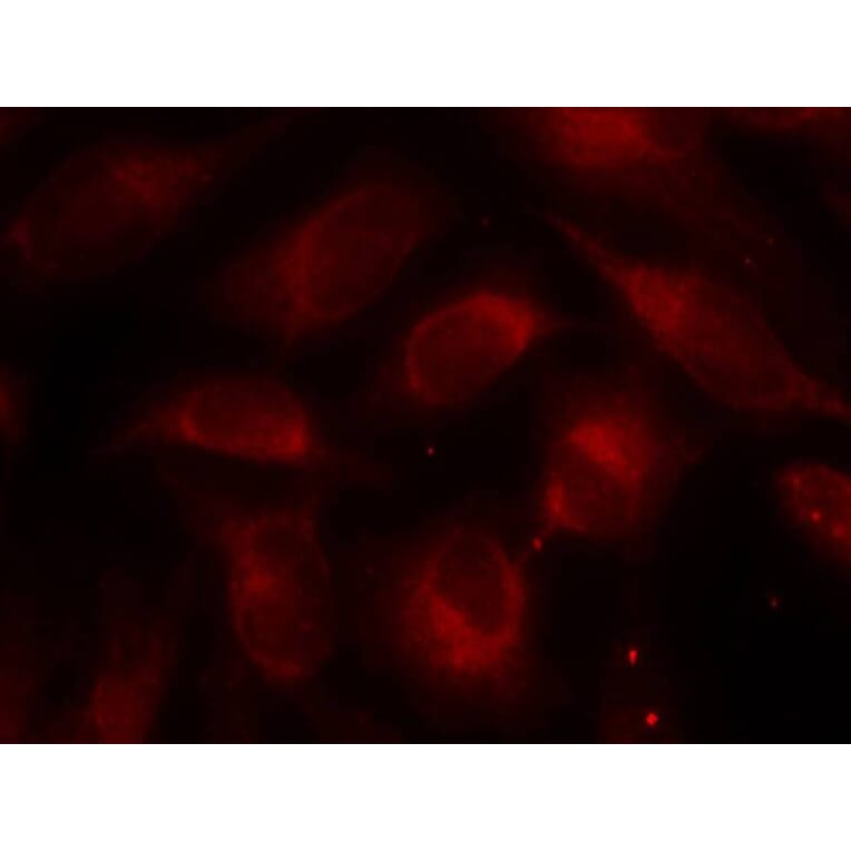 Immunofluorescence - p70 S6 Kinase (Ab-389) Antibody from Signalway Antibody (21182) - Antibodies.com