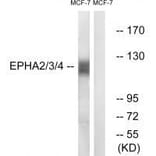 Western blot - EPHA2/3/4 (Ab-588/596) Antibody from Signalway Antibody (33159) - Antibodies.com