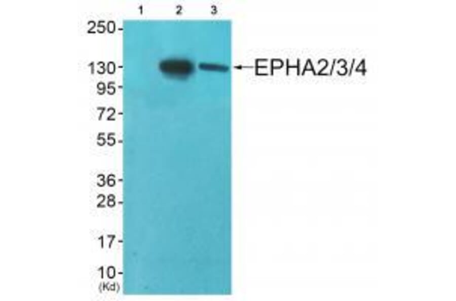 Western blot - EPHA2/3/4 (Ab-588/596) Antibody from Signalway Antibody (33159) - Antibodies.com