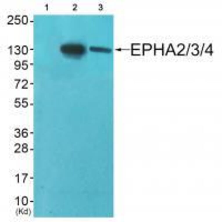 Western blot - EPHA2/3/4 (Ab-588/596) Antibody from Signalway Antibody (33159) - Antibodies.com