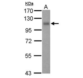 Thrombomodulin (CD141) antibody from Signalway Antibody (22197) - Antibodies.com