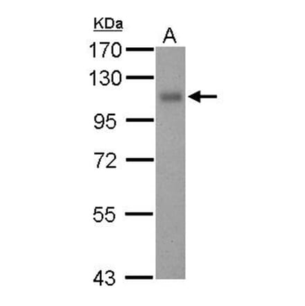 Thrombomodulin (CD141) antibody from Signalway Antibody (22197) - Antibodies.com