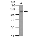 Thrombomodulin (CD141) antibody from Signalway Antibody (22197) - Antibodies.com