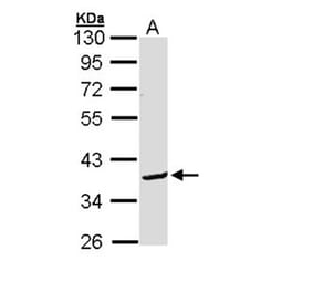 Bcl-2-like protein 12 antibody from Signalway Antibody (22281) - Antibodies.com