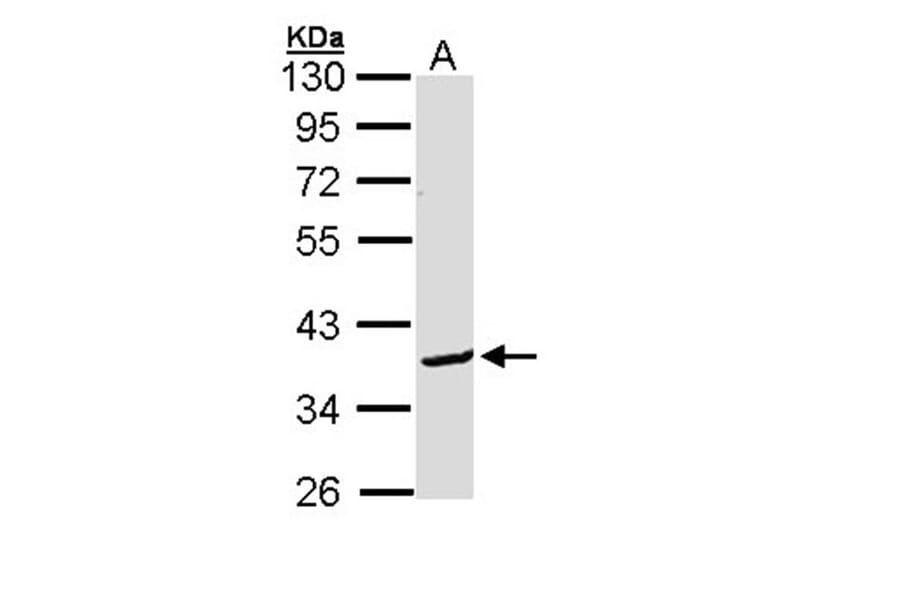 Bcl-2-like protein 12 antibody from Signalway Antibody (22281) - Antibodies.com