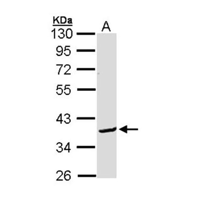 Bcl-2-like protein 12 antibody from Signalway Antibody (22281) - Antibodies.com